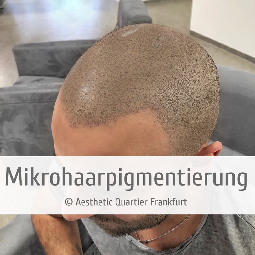 Methode der Haarpigmentierung