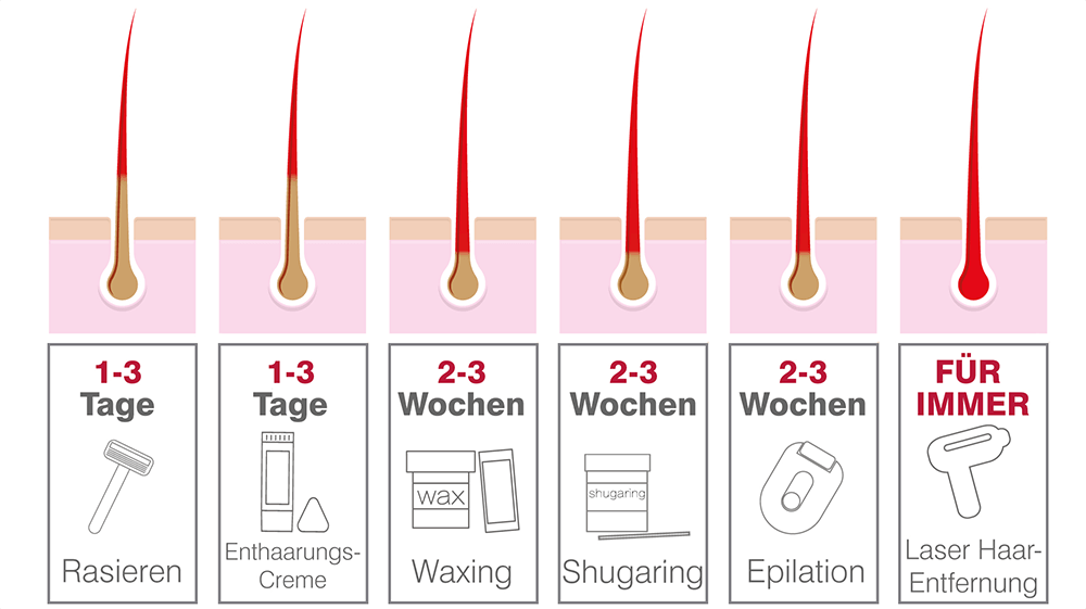 Welche Art von Haarentfernung ist die beste?