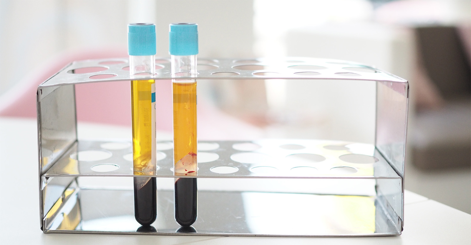 PRP Eigenblutbehandlung vs. Stammzellentherapie